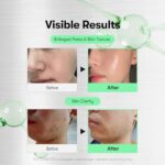 VT COSMETICS CICA Reedle Shot 100, Spicule Microneedling Serum result