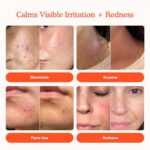 Tower 28 SOS Daily Rescue Facial Spray for Skin Irritation and redness