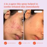 Tower 28 SOS Daily Rescue Facial Spray for Sensitive Skin effect