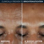 : RoC Multi Correxion Revive + Glow results