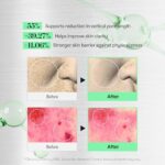 VT COSMETICS CICA Reedle Shot 100, Spicule Microneedling Serum results